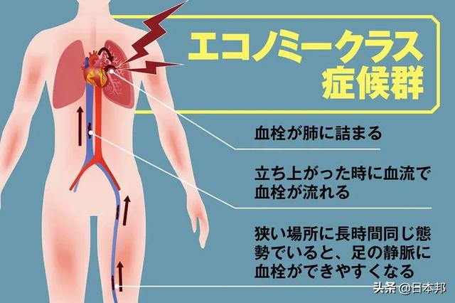 日本式方舱将长什么样子？成田机场隔离区是范例。